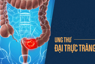 CÁC YẾU TỐ NGUY CƠ - CÁCH PHÒNG NGỪA UNG THƯ ĐẠI TRỰC TRÀNG